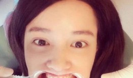 娱乐圈吃瓜张大奕,揭秘张大奕的明星生活与争议风波